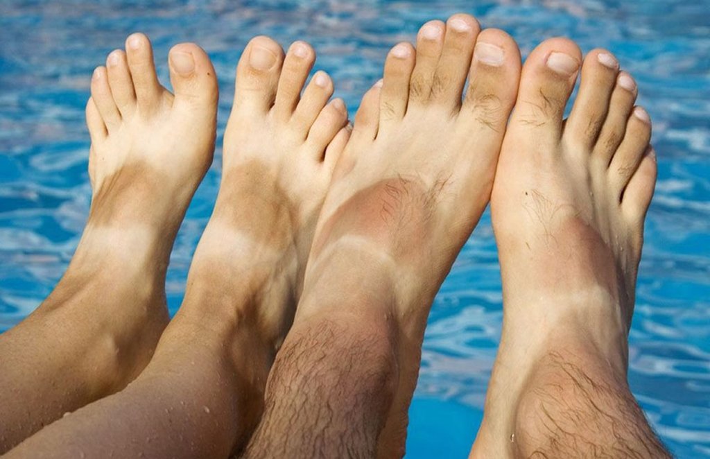 how to remove tanning on foot, how to remove tanning from feet and hands, how to get rid of tanning on feet