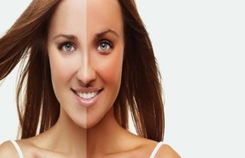 How to remove tanning marks, How to remove tanning, How to get rid of tanning marks