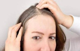 hair, hair problems, hair fall, hair fall problems, malaika arora, malaika arora instagram