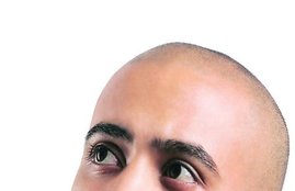 hair, hair problems, hair fall, white hair, dandruff, baldness, dos and donts for good hair