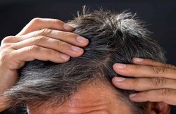 White Hair: कम उम्र में सफेद बालों की परेशानी को दूर करने में रामबाण माने जाते हैं ये 5 घरेलू उपचार