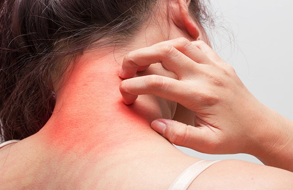 how to get rid of skin problems, how to get rid of skin disease, skin problems