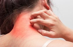 ये 5 घरेलू उपाय स्किन इंफेक्शन को दूर करने में हैं असरदार, जानिये कैसे करें इस्तेमाल