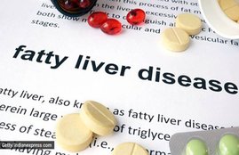 fatty liver, fatty liver symptoms, fatty liver precautions, tips for fatty liver patients