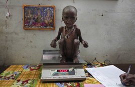 Malnutrition, India, World