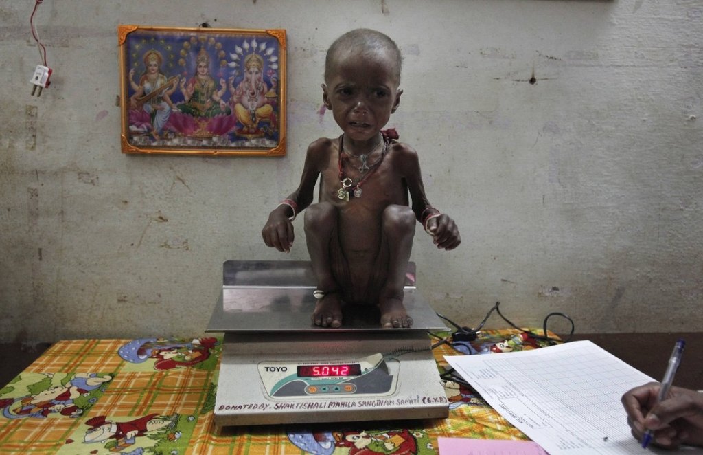 Malnutrition, India, World