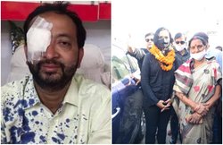 बिहार: पप्पू यादव के बाद CM उम्मीदवार पुष्पम प्रिया के प्रत्याशी पर सीवान में हमला, आंख क्षतिग्रस्त