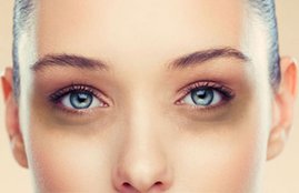 How to get rid of dark circles, dark circles home remedies in Hindi, dark circle home remedy