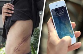 iphone, kidney, chinese man