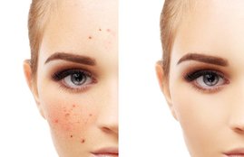 skin, skin problem, pigmentation