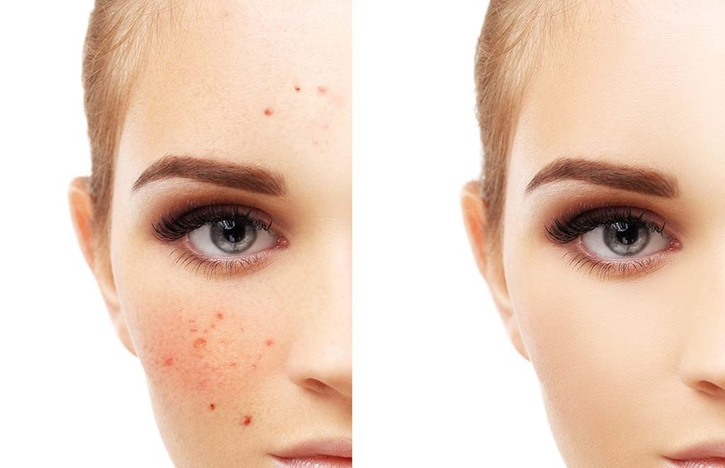 skin, skin problem, pigmentation
