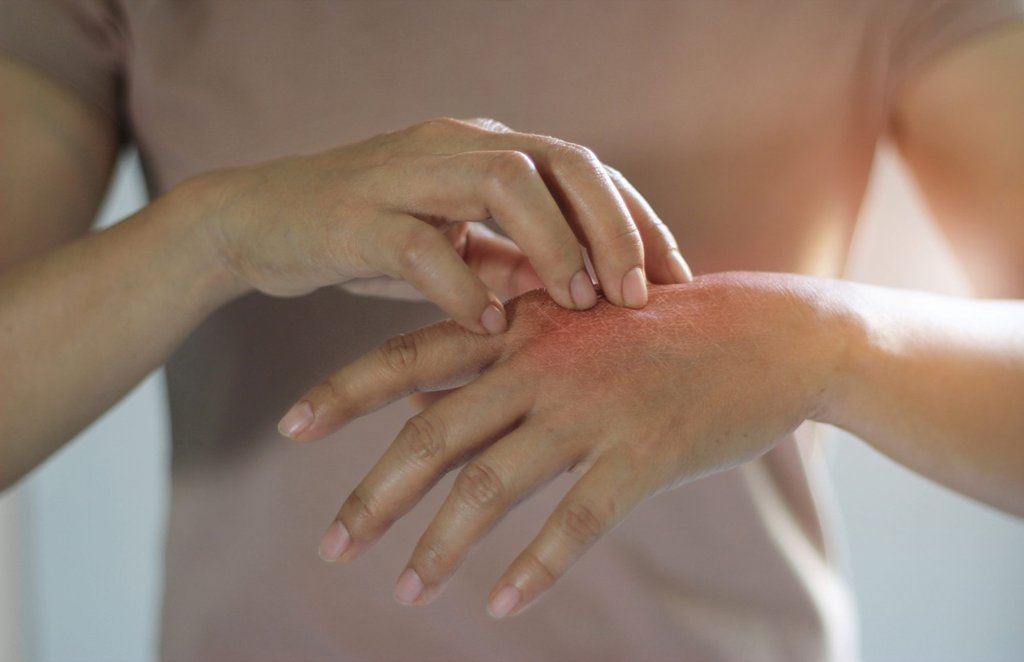 skin infections, skin, skin problems