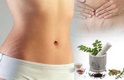 प्रेग्नेंसी के स्ट्रेच मार्क्स से निजात पाने के लिए इन घरेलू उपायों को माना जाता है मददगार, जानें