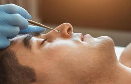 blackheads, skincare, winter skincare, beauty diy videos, skin problems