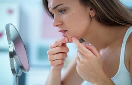 skincare, skincare tips in hindi, glowing skin, acne, pimples, pimple remedies