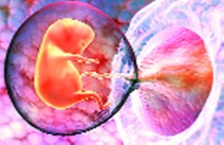 शोध: अजन्मे बच्चे की गर्भनाल में मिले ‘माइक्रोप्लास्टिक’ के सबूत