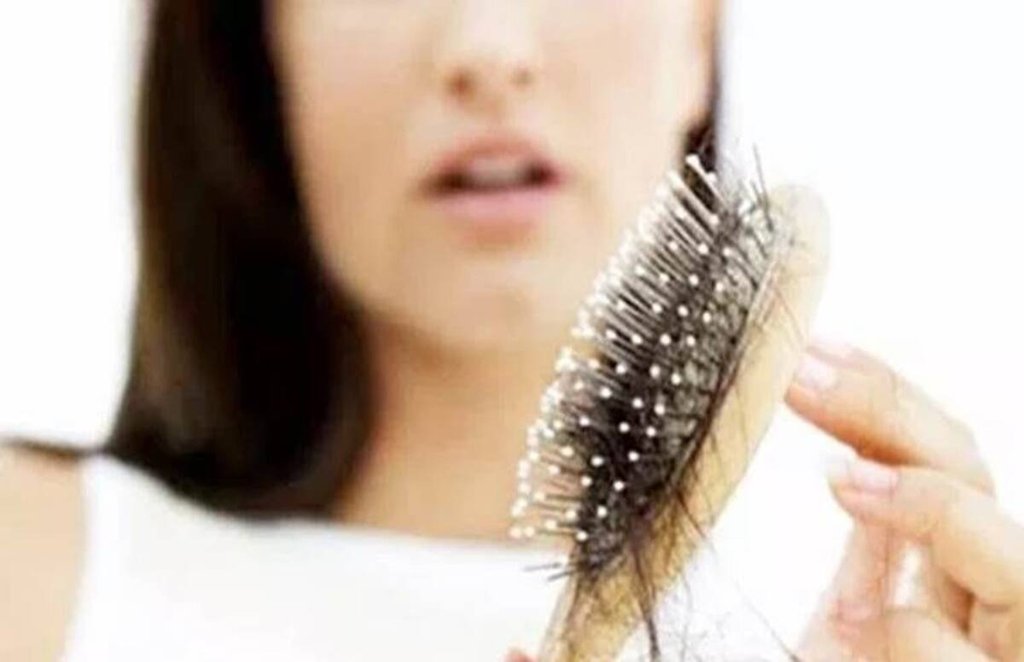 hair problems, winter hair fall, hair fall, hair loss, dandruff, White Hair