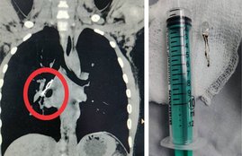 critical operation