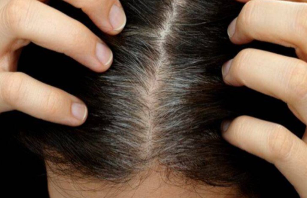 white hair, white hair reasons, white hair vitamin deficiency