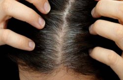 बाल सफ़ेद होने के पीछे वजह कहीं इन विटामिन्स की कमी तो नहीं? जानिये कैसे करें इस कमी को दूर