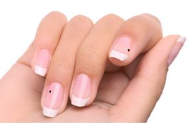 mole, mole nails, nails mole