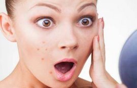 pimples, skin diseases, pimples reasons, skincare tips in hindi