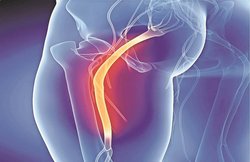 नसों के दर्द की समस्या, दर्द से निजात हिदायत के साथ