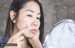 चेहरे या गर्दन पर काले धब्बे हो सकते हैं ब्लड शुगर बढ़ने के संकेत, जानें दूसरे लक्षण और बचाव के तरीके