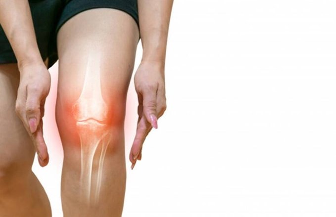 Uric Acid, joint pain, joint swelling, gout, gathiya, arthritis