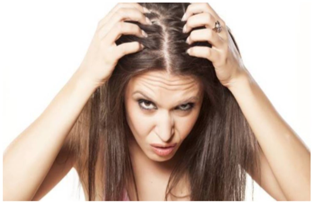 hair care, hair care tips, dandruff