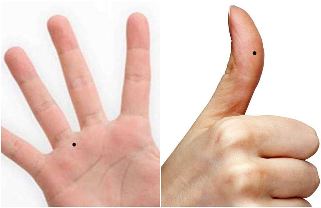 palmistry, moles on palm, Samudrik Shastra, moles on body, moles on hand, palmistry, moles on palm, Samudrik Shastra, moles on body, moles on hand,