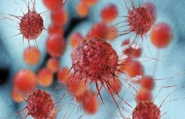 uterus Cancer, health, symptoms of uterus cancer