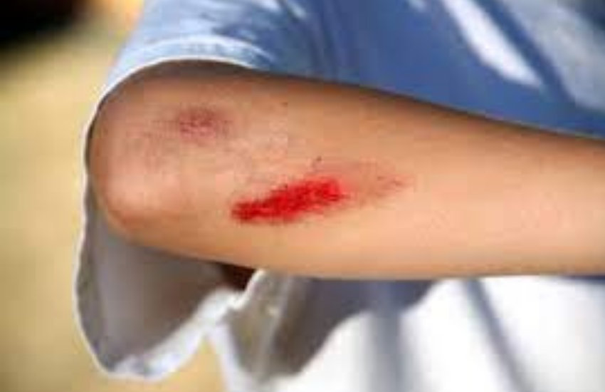 Corona Infection, Covid-19, Identification of Weak Immunity