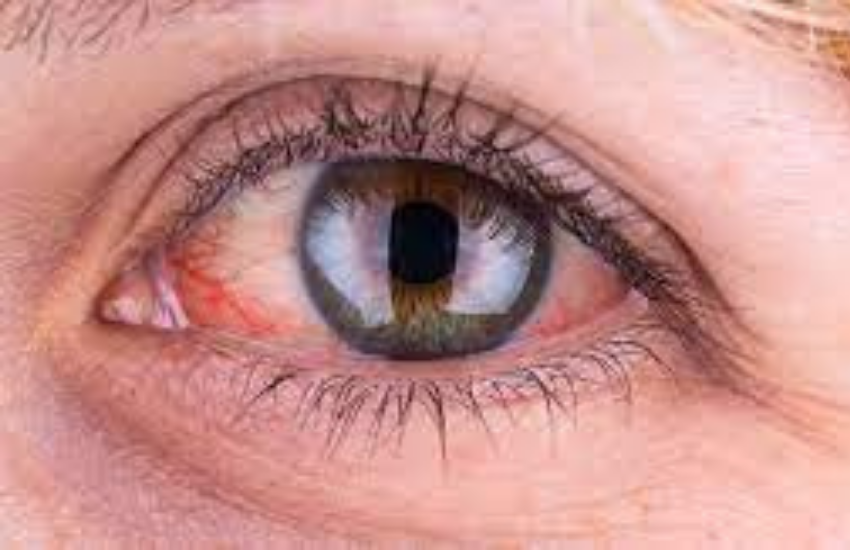Corona infection, corona infection symptoms
