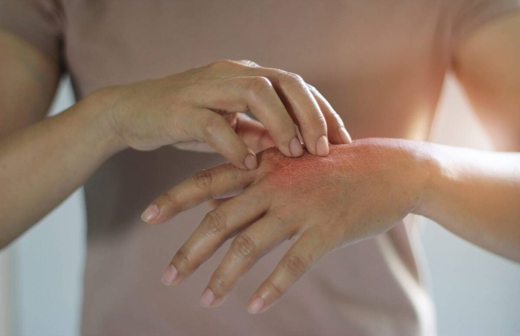 diabetes, high blood sugar, diabetes symptoms, skincare