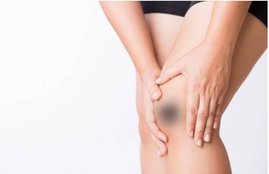 black knees, home remedies from black knees, skin care