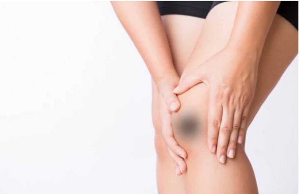 black knees, home remedies from black knees, skin care