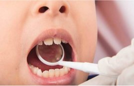 children teeth, dentist, crooked teeth in kids
