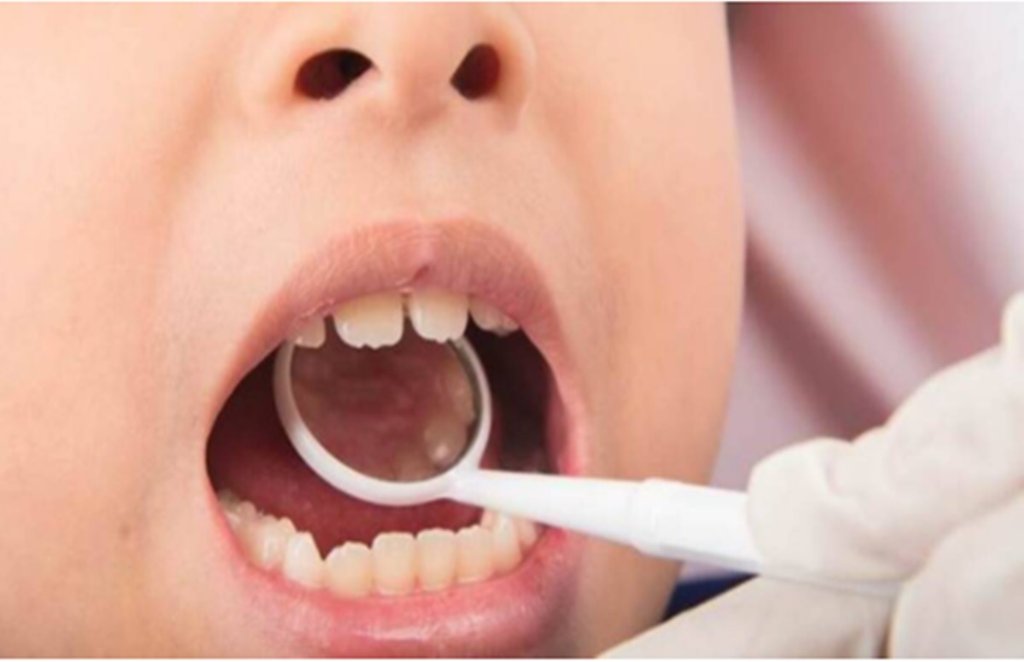 children teeth, dentist, crooked teeth in kids