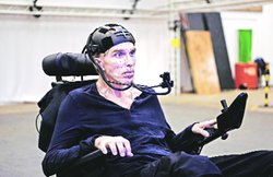 दुनिया में पहली बार आधा इंसान आधा रोबोट