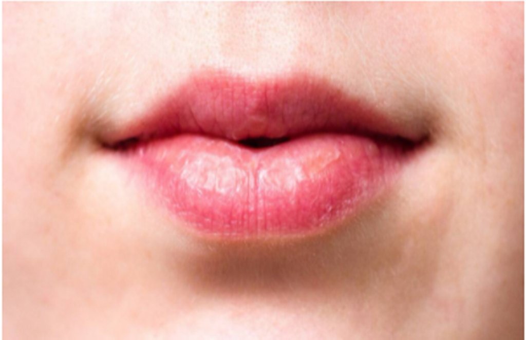 lips, home remedies, home made scrub