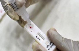 Coronavirus, COVID-19 Testing