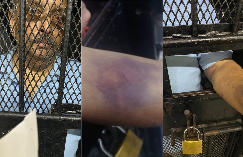 Mehul Choksi, PNB Scam, India News