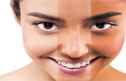 सनटैन से छुटकारा दिलाने में इन 6 घरेलू उपायों को माना जाता है मददगार, जानिये