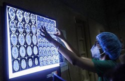 कोरोना के बीच 15 राज्यों में फैला Black Fungus, 10 में महामारी घोषित; स्टडी में दावा- मर्दों, डायबिटीज वालों को अधिक खतरा