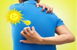 गर्मी में घमैरियों ने कर दिया है परेशान तो ये घरेलू उपाय दिला सकते हैं निजात