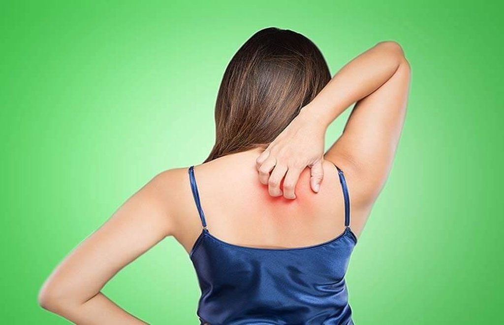 skincare tips, skin tips, beauty tips, skin infection