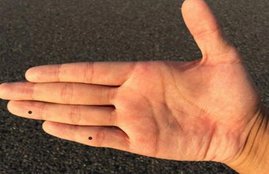body mole, face mole, mole on face, palm mole meaning, hand mole meaning, moles meaning in hindi