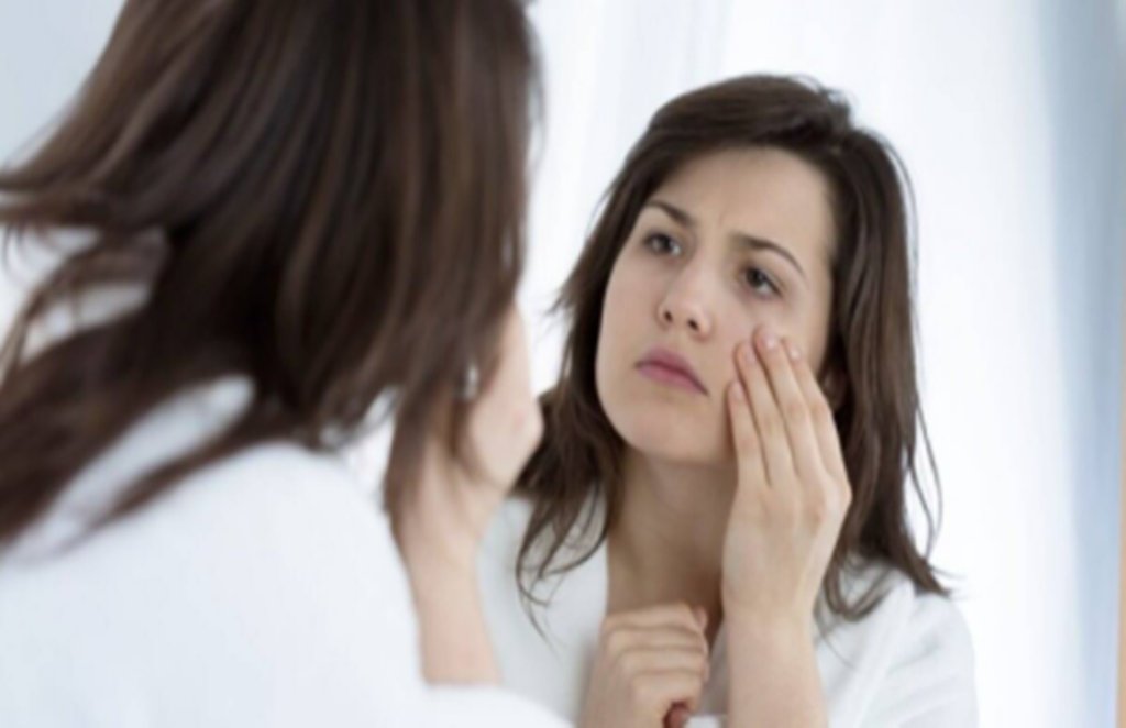 dark circles, beauty tips, beauty