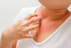 बढ़ते ब्लड शुगर की निशानी हो सकते हैं ये 3 स्किन प्रॉब्लम्स, ध्यान में रखें ये&nbsp;बातें